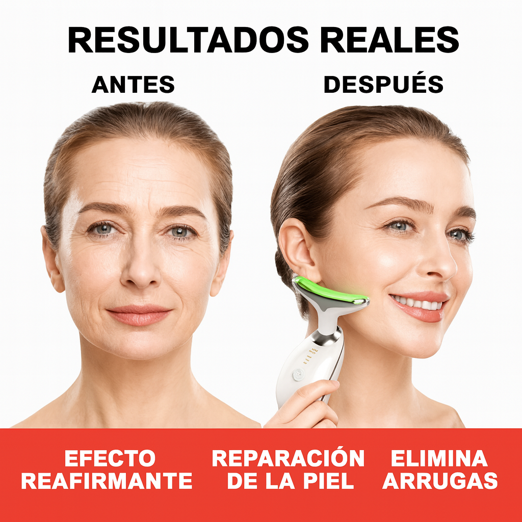 Elimina tus Arrugas con DermaLuxe